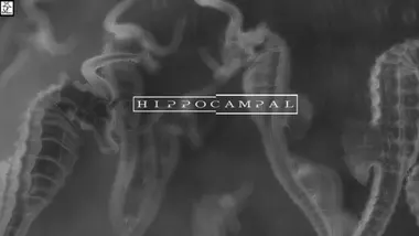 Hippocampal: The White Sofa preview 4