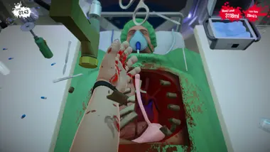 Surgeon Simulator Anniversary Edition preview 9
