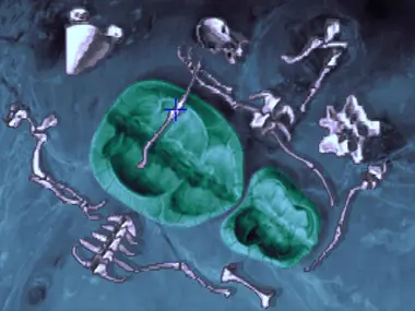 The Dig preview 5